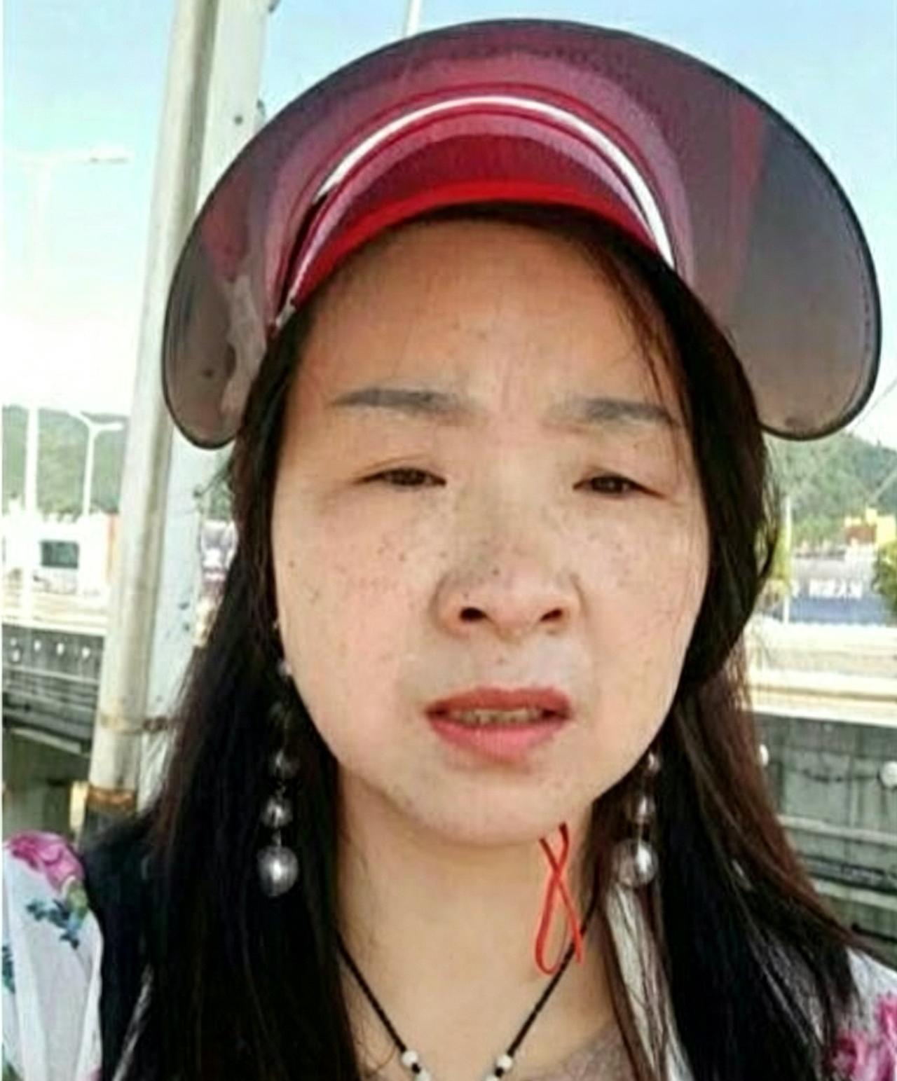 人到中年，脸上长满日晒斑、岁月斑熬夜劳累、气血不足、内分泌不稳，斑就反反复复