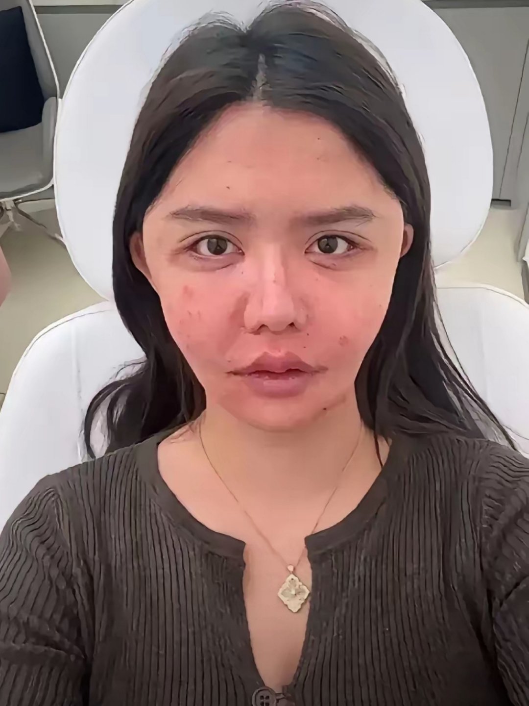 韩安冉想照着Angelababy整“结婚博主”韩安冉直播称自己最爱的女明星是A