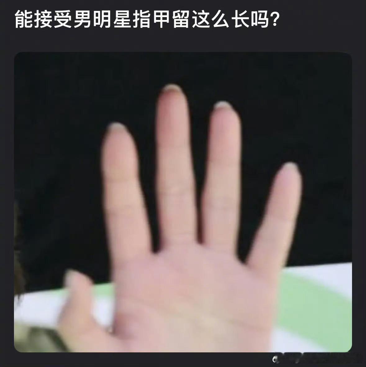 丁禹兮指甲是不是过长了，男明星留长指甲你能理解吗​​​