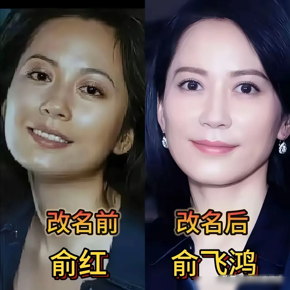 王鸥出道旧照流出，整没整容一眼看穿！2003年CCTV模特大赛旧照里，她身高比一众超模偏矮，早年皮肤