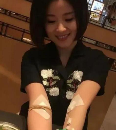 2017年，浙江一28岁女孩无偿捐献骨髓，救了一名15岁白血病男孩。没想到，男孩