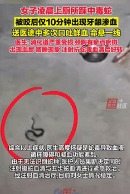 真够倒霉的！云南昭通，一女子凌晨起来上厕所，可没想到，刚从房间里出来，恰好踩到一