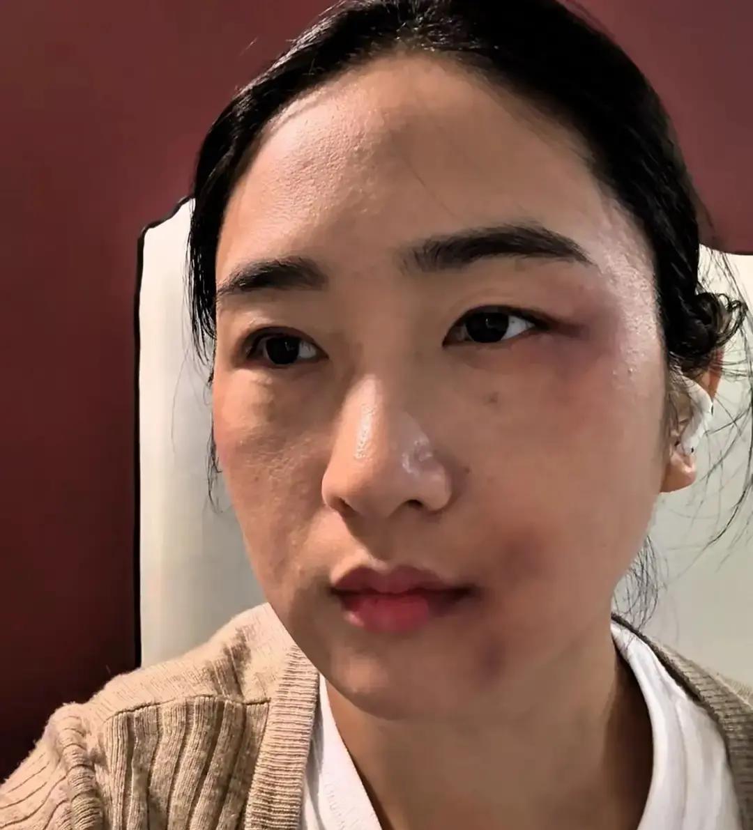 “爱是相互的！”楼上王姐被家暴十几年，那天她问14岁的儿子：“你爸再打我，你帮谁