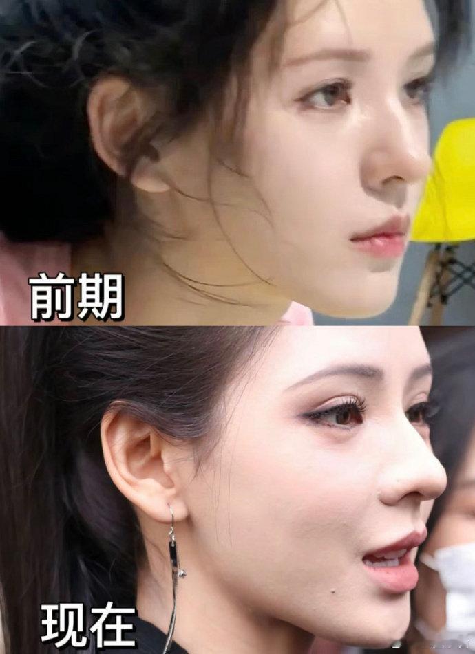 女生长期化妆对皮肤状态是不是也有影响？​​​