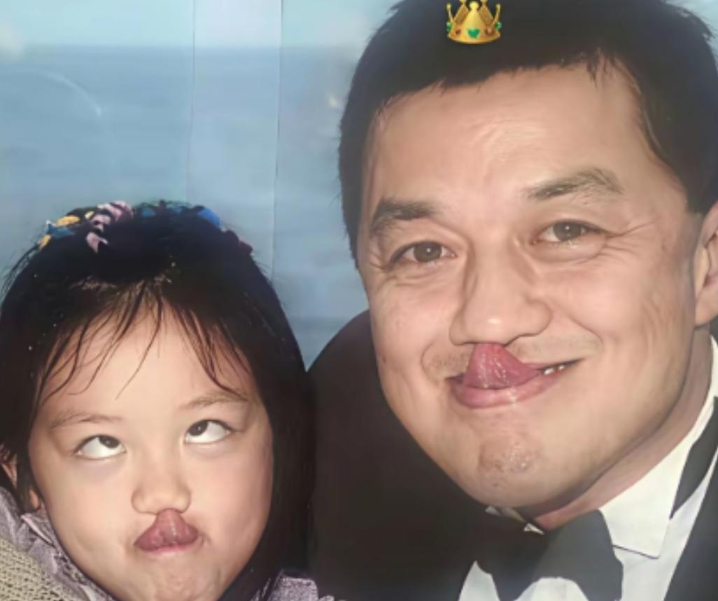 2006年5月27日中午，李亚鹏在北京协和医院走廊站着，手里捏着那张B超单，上面