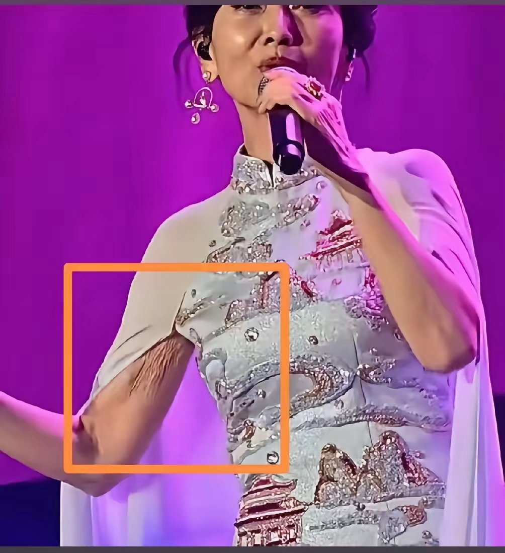 赵雅芝出席活动胳膊成焦点，这是赵雅芝最失败的一次穿搭，她不应该穿这个衣服，人到