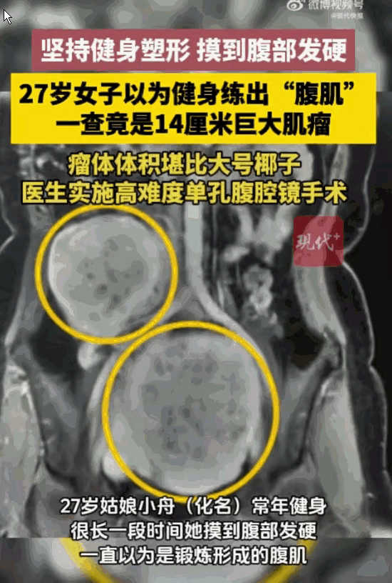 这也太狠了！江苏南通，一个27岁的姑娘，满心欢喜地以为自己卷出了人人羡慕的马甲线