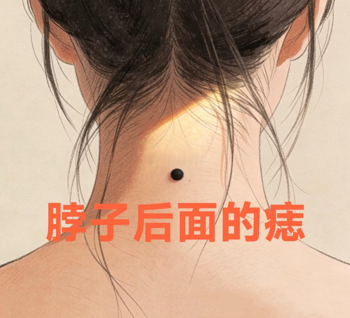 脖子后面长痣，有两种说法：一种是背有靠山，容易得贵人相助，关键时刻总有人拉一把，