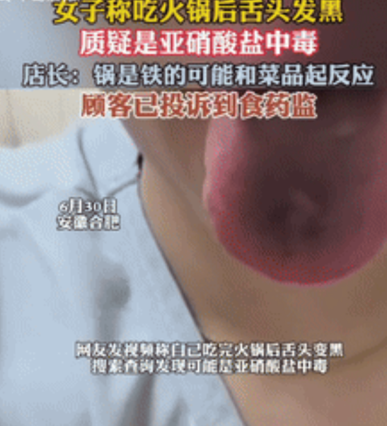 “离大谱！”安徽合肥，一女子吃完火锅后舌头变黑，上网查询发现可能是亚硝酸盐中毒，