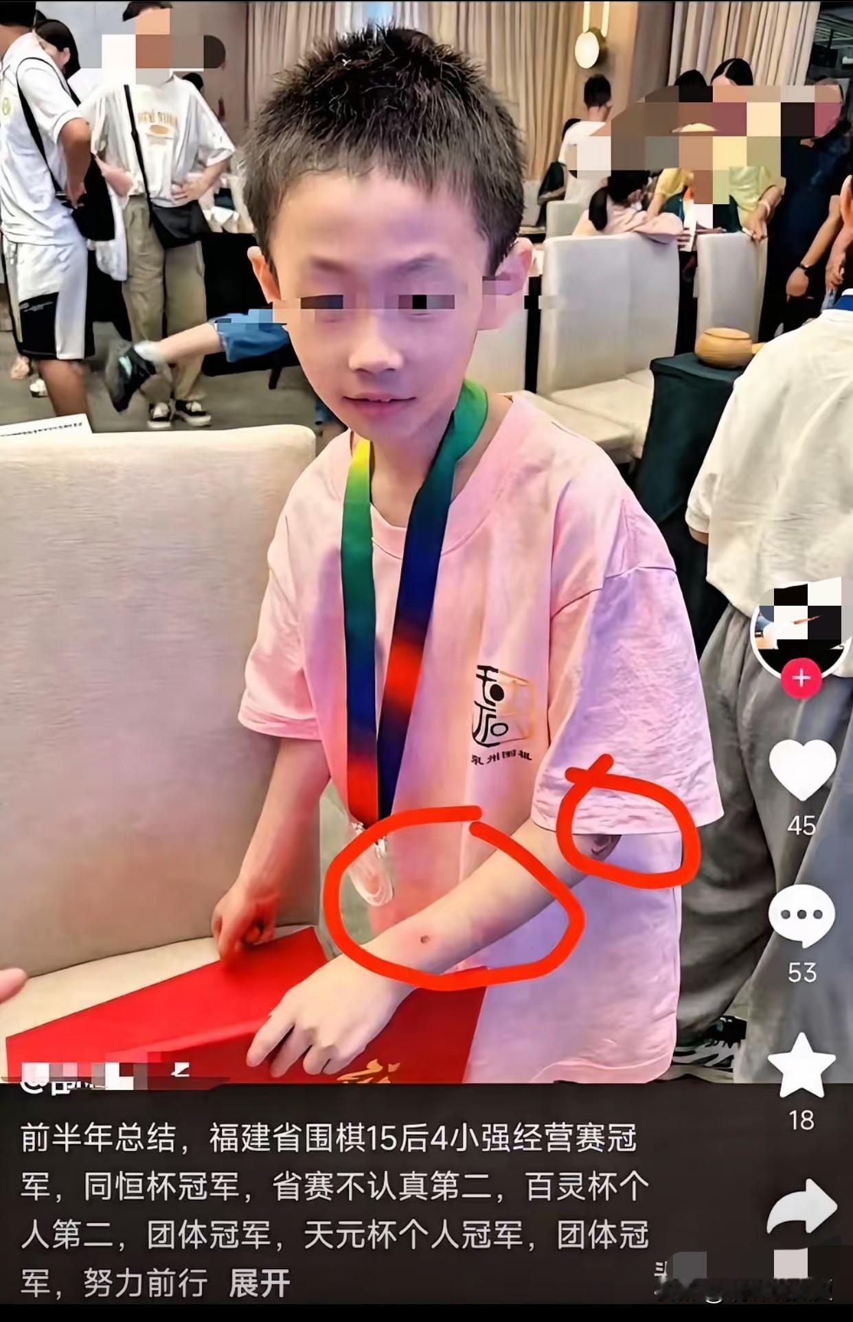 全网心痛！围棋天才少年跳楼！9岁的孩子到底扛了多少重压？19号晚上，围棋天才