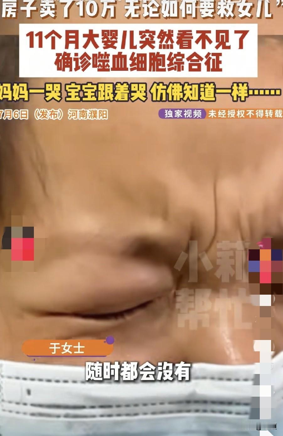 河南濮阳11个月大的婴儿眼睛突然看不见了，被确诊噬血细胞综合症，医生告诉父母，孩
