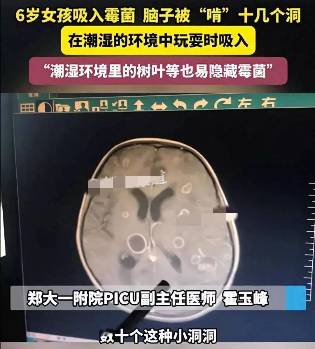 太吓人！家里这东西是Ⅰ类致癌物，6岁娃脑子被“啃”出十几个洞！谁能想到，天
