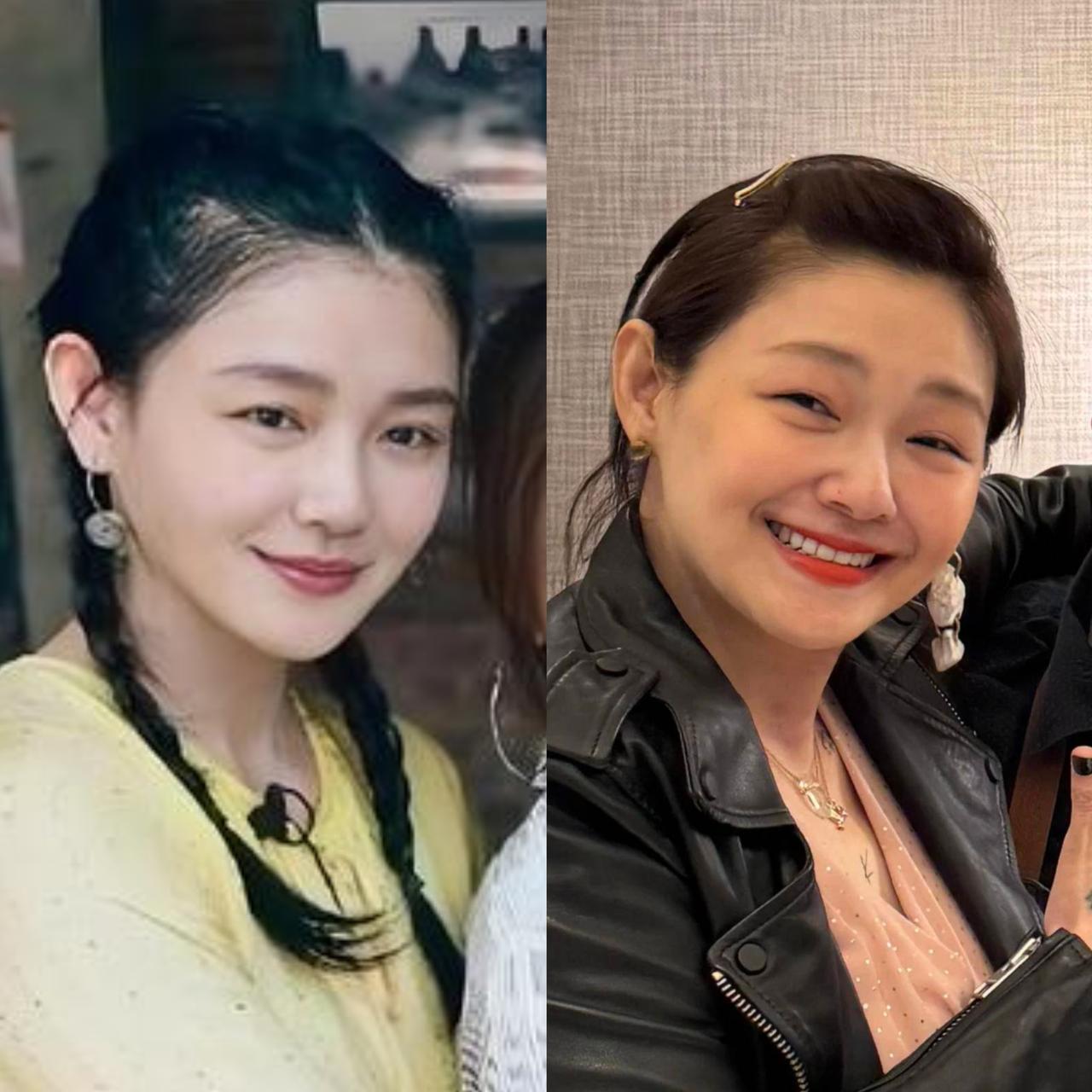 其实大S和汪小菲婚姻那十年，状态并不算很差，脸型和五官基本没怎么变，只是因为年纪