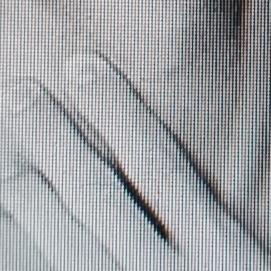 甲减别慌，掌握这几点，逆转不是梦！饮食上，要多吃富含碘的食物，像海带、紫菜，碘