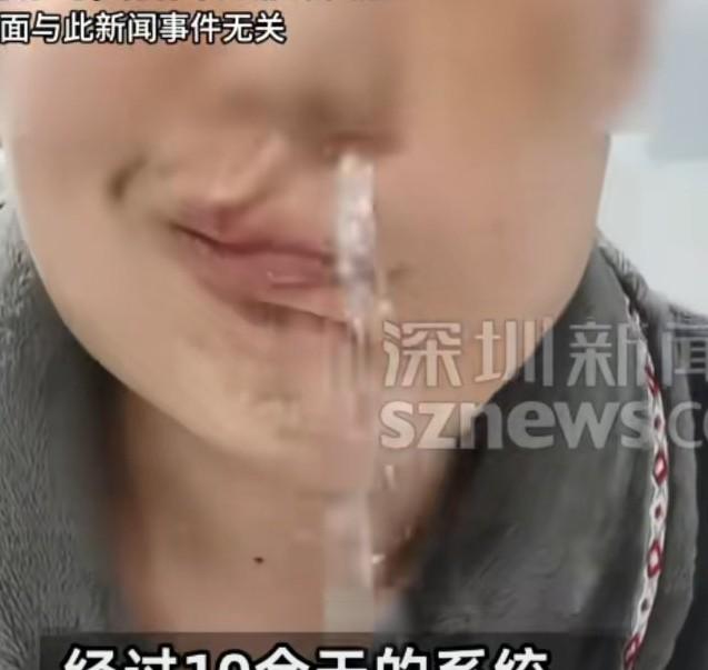 男子睡前开窗被凉风直吹，一觉醒来发现左脸僵硬发麻，嘴角歪斜，左眼无法闭合，刷