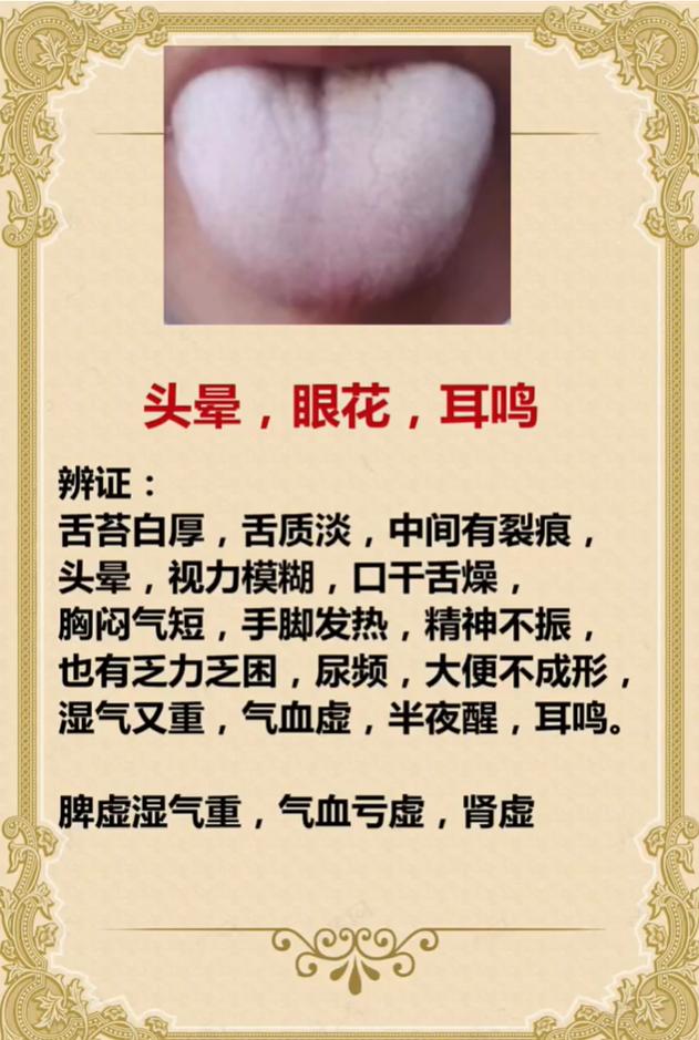头晕眼花还耳鸣？多半是脾虚湿气重、气血亏虚、肾虚