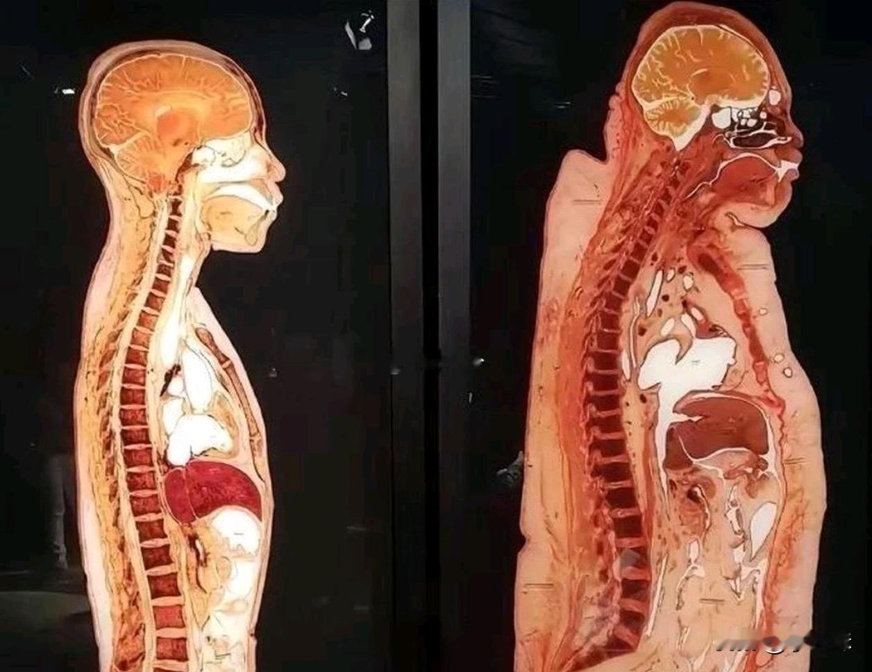 感受一下瘦子和胖子的直接差别