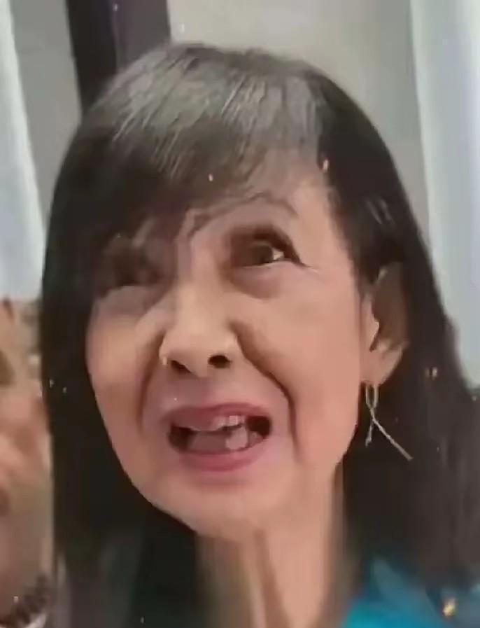 周慧敏瘦了，不是饿的，是动了刀。颌骨复位+牙周手术，一个月只能喝营养奶，体重掉
