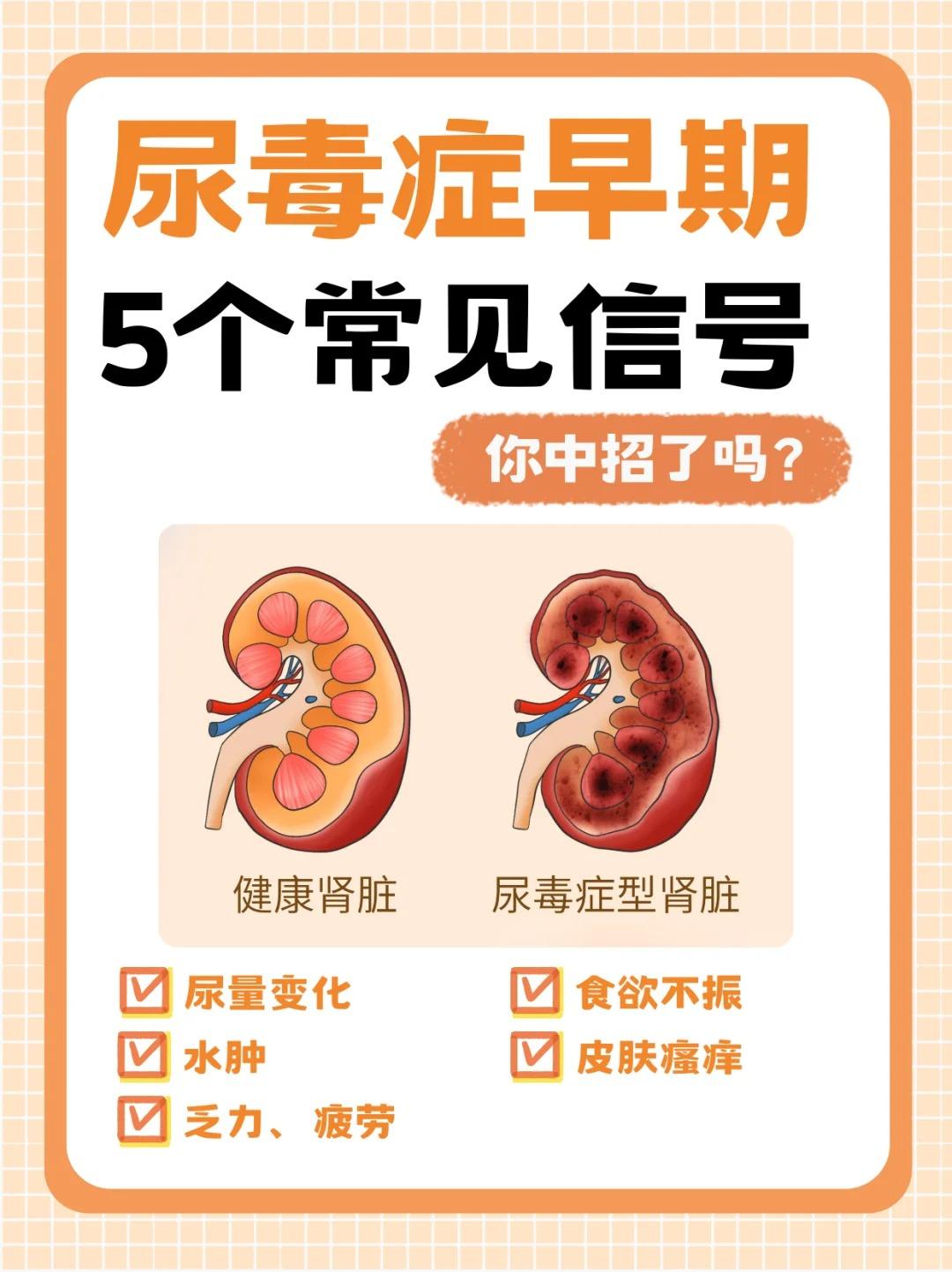 尿毒症早期五个常见信号你中招了吗？