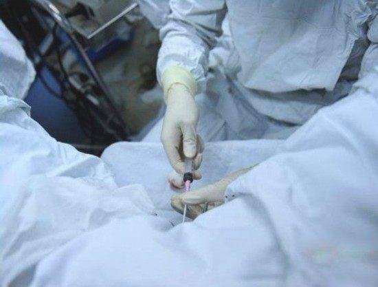 做试管婴儿怎么取卵子? 如何让卵子快点成熟?