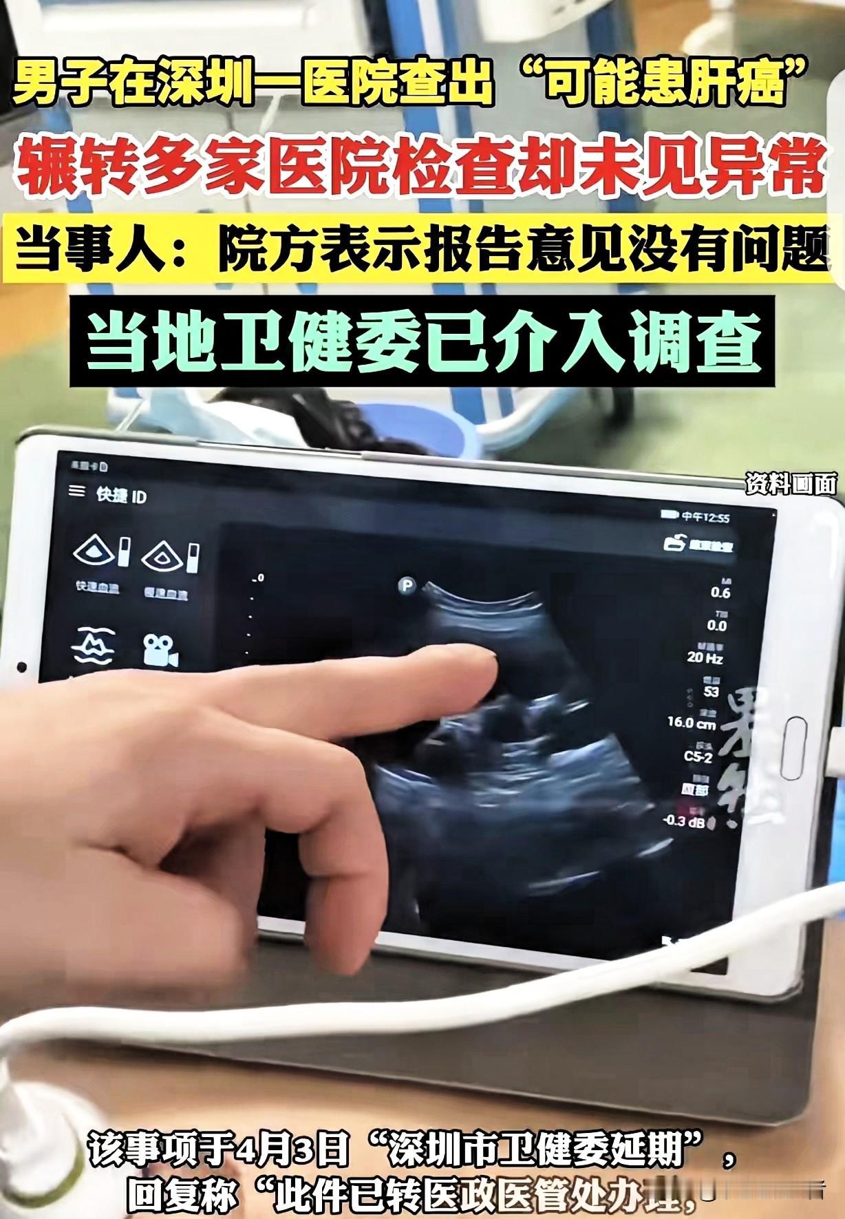 “真荒唐！”广东深圳，一男子在医院查出“可能患肝癌”，可把他吓坏了，觉得天都塌了