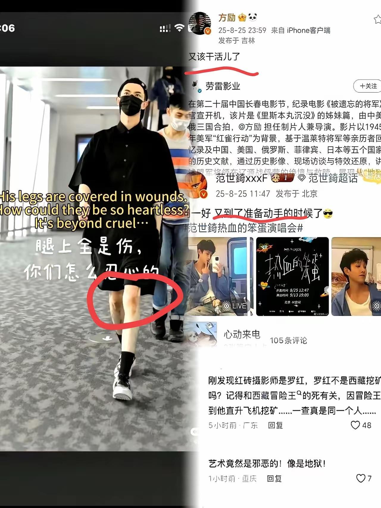 盯着那张照片翻来覆去放大，屏幕里腿上的淤青都透着一股子钻心的疼——之前听人说他口