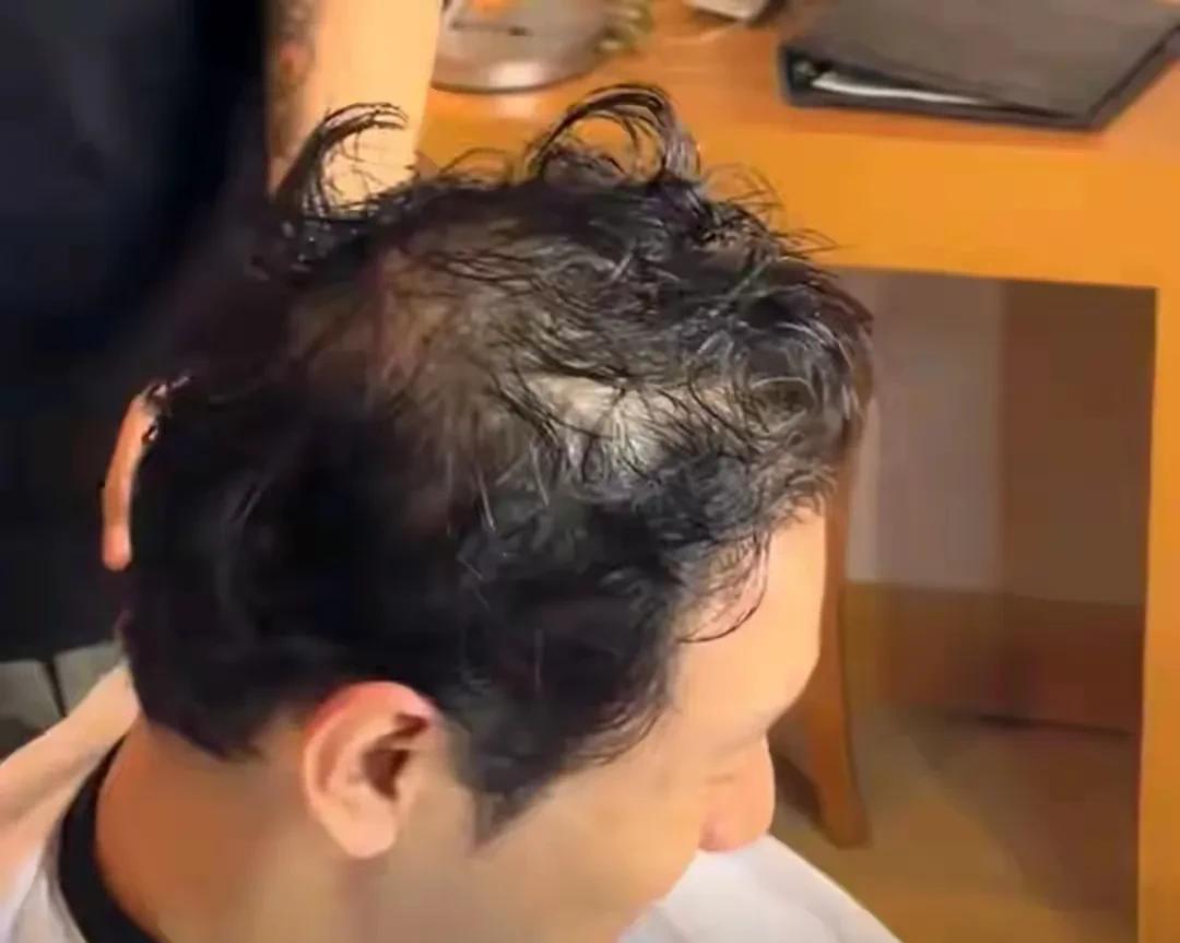 原来黄晓明那乌黑浓密的头发都是假的呀！看这头发少的都要谢顶了，难怪小教主曾经说