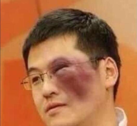 步行者能不能打所有人的脸？赛季初37人预测总冠军会花落谁家，其中预测凯尔特人