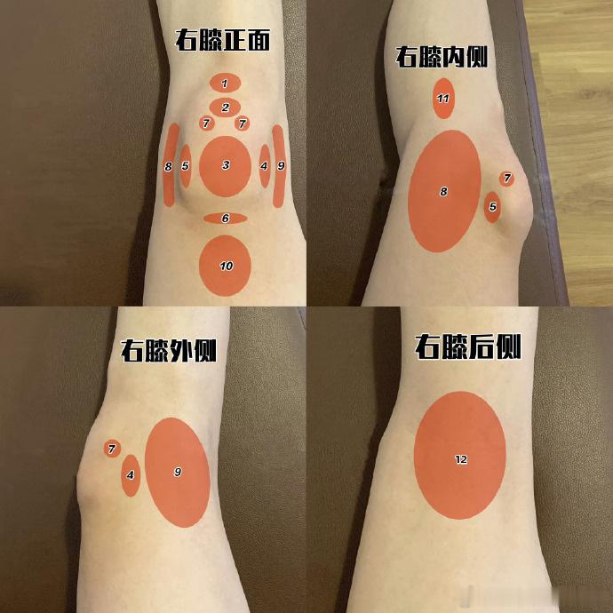 膝关节损伤这两天讲膝盖损伤比较多，那来看这张图——膝关节疼痛位置盘点，你的疼