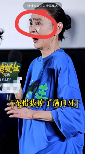 真相来了！刘雪华亲自澄清了，满口牙不是拔的，不是拔的，是自己摘下来的假牙！