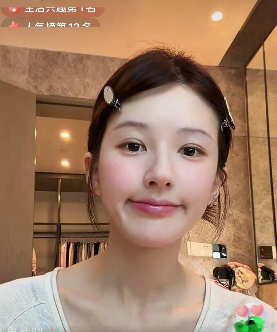 赵露思怎么一个鼻孔大一个鼻孔小这是什么后遗症吗
