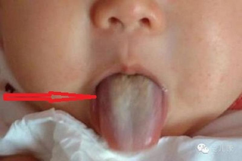 半个橙子撒把盐, 孩子吃一口, 咳嗽立“蒸发”!