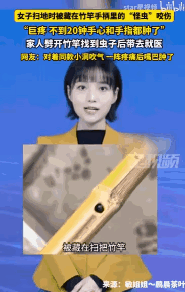 惊魂21分钟：女子扫地遭竹竿“暗器”偷袭，手掌瞬间肿成馒头！网友不信邪对嘴吹气，