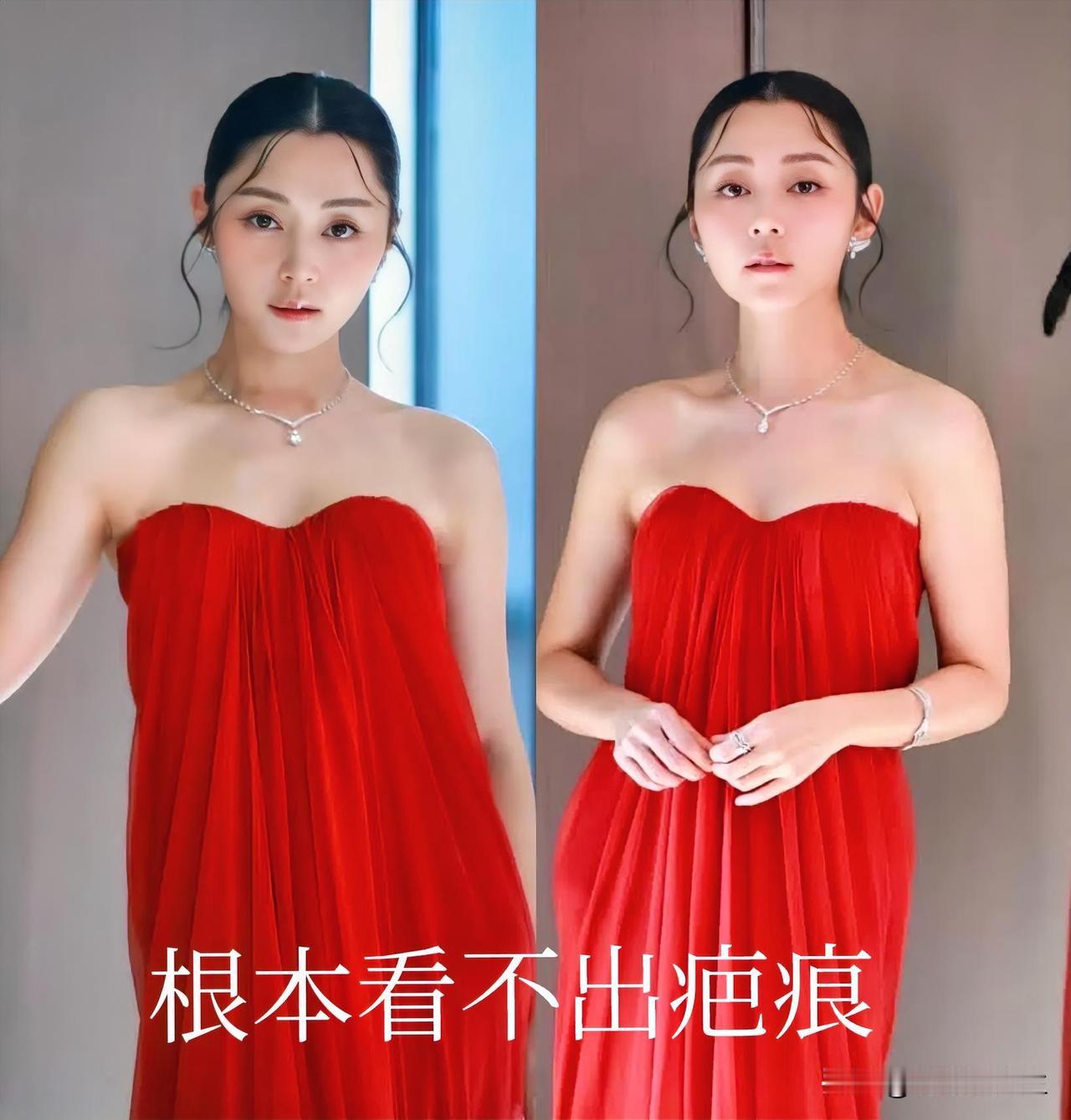 听网友说卫诗雅的嘴受过伤，而且缝了50多针，很多人看到她现在那张脸，都惊呼完全看