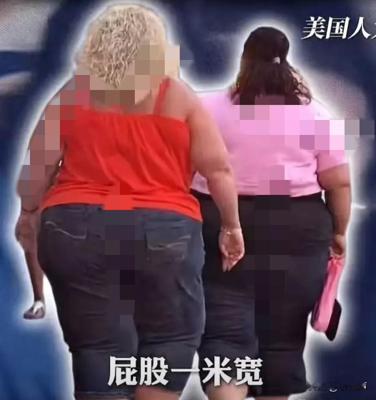 人均糖尿病日吃77克糖！美国人吃糖=8倍中国人肥胖糖尿病扎堆，咖啡里能加四分