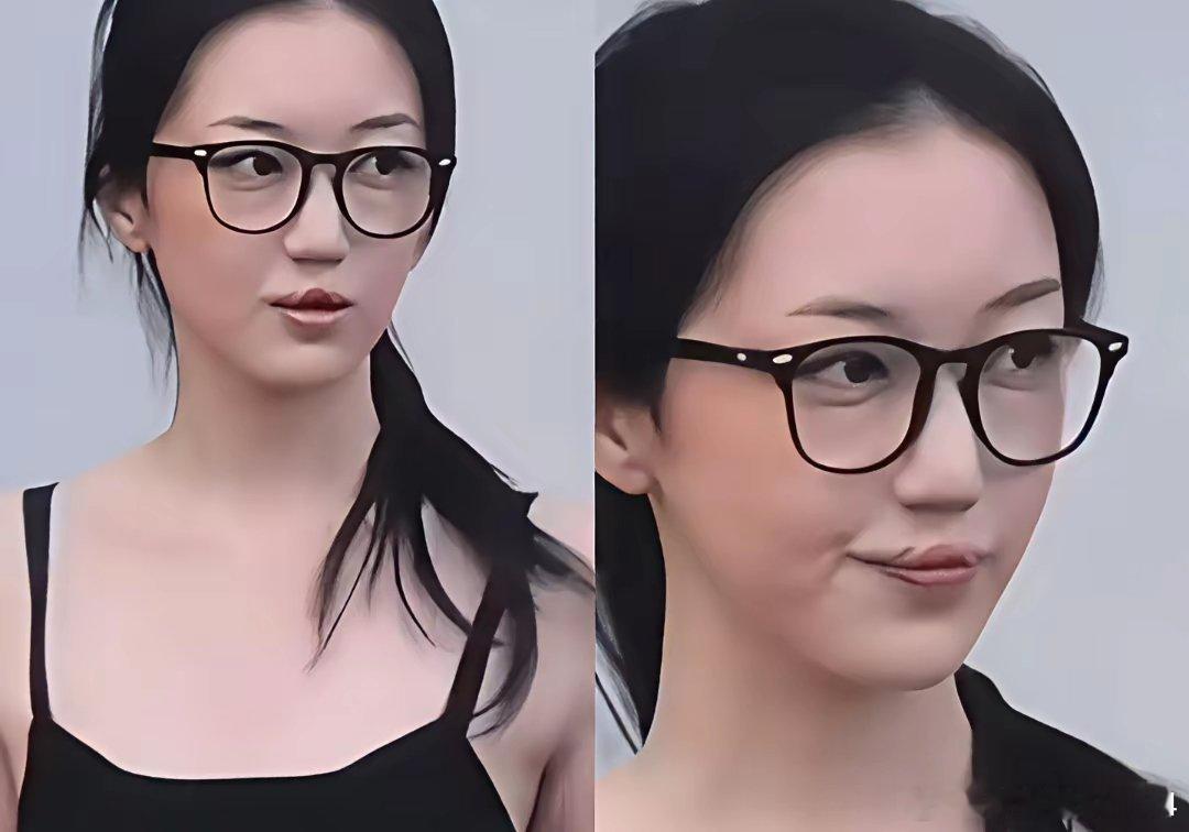 王菲当年在杨澜的节目里，谈到怀着李嫣时，医生已经明确告知是严重畸形唇裂，但她斩钉截铁地说：“是我必须
