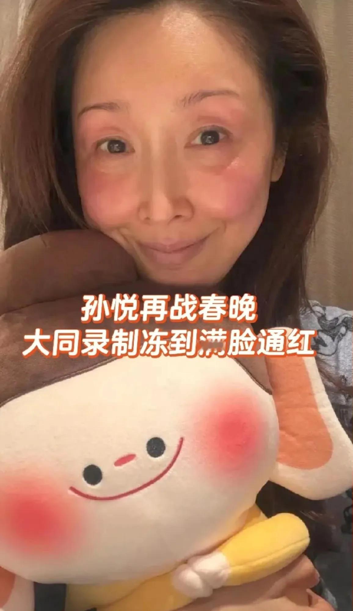 孙悦录民歌春晚被冻伤！孙悦于2026年1月21日在微博发布冻伤照片，可见其眼周