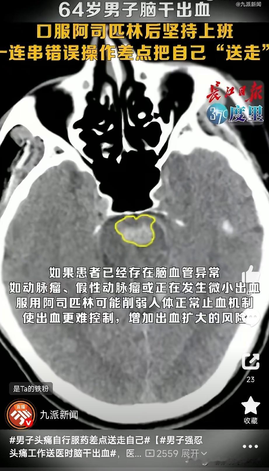 头痛强忍一天还吃阿司匹林，64岁男子差点送走自己！头痛不是病，疼起来真要命？