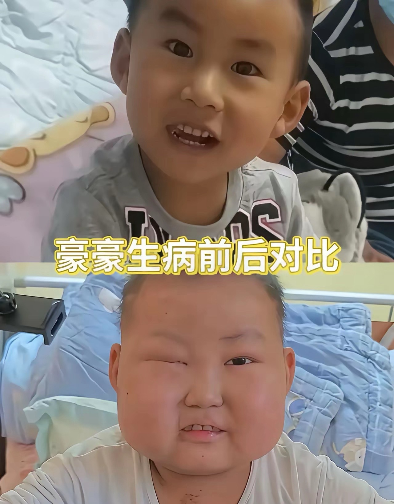 坚强的小豪豪走了，没有撑到过年。豪豪爸爸说，坚持了六年多，不得已放弃治疗吧。也许