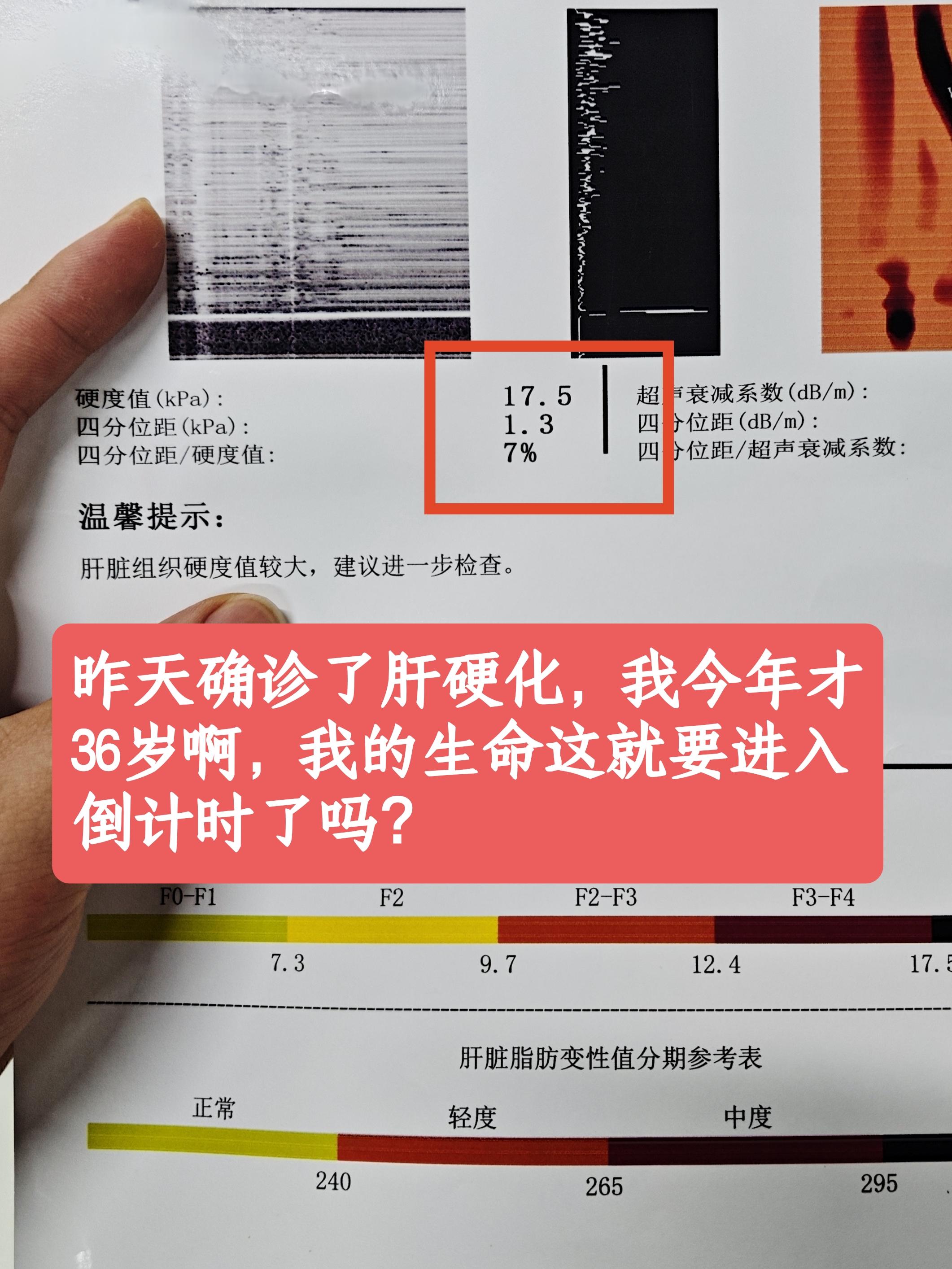 单位体检结果出来了，我，今年才36岁！一个自认还算健康的普通人，被赫然...
