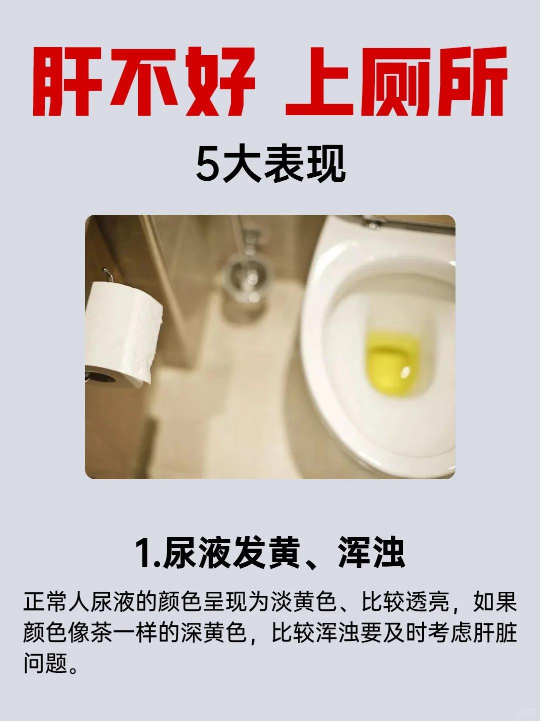 上厕所的5种表现！可能是肝不好！