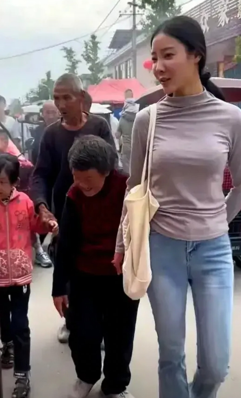 河南网红李富贵，长的真的漂亮，只是太可惜了。这么漂亮的女孩，从医学的角度来说，父