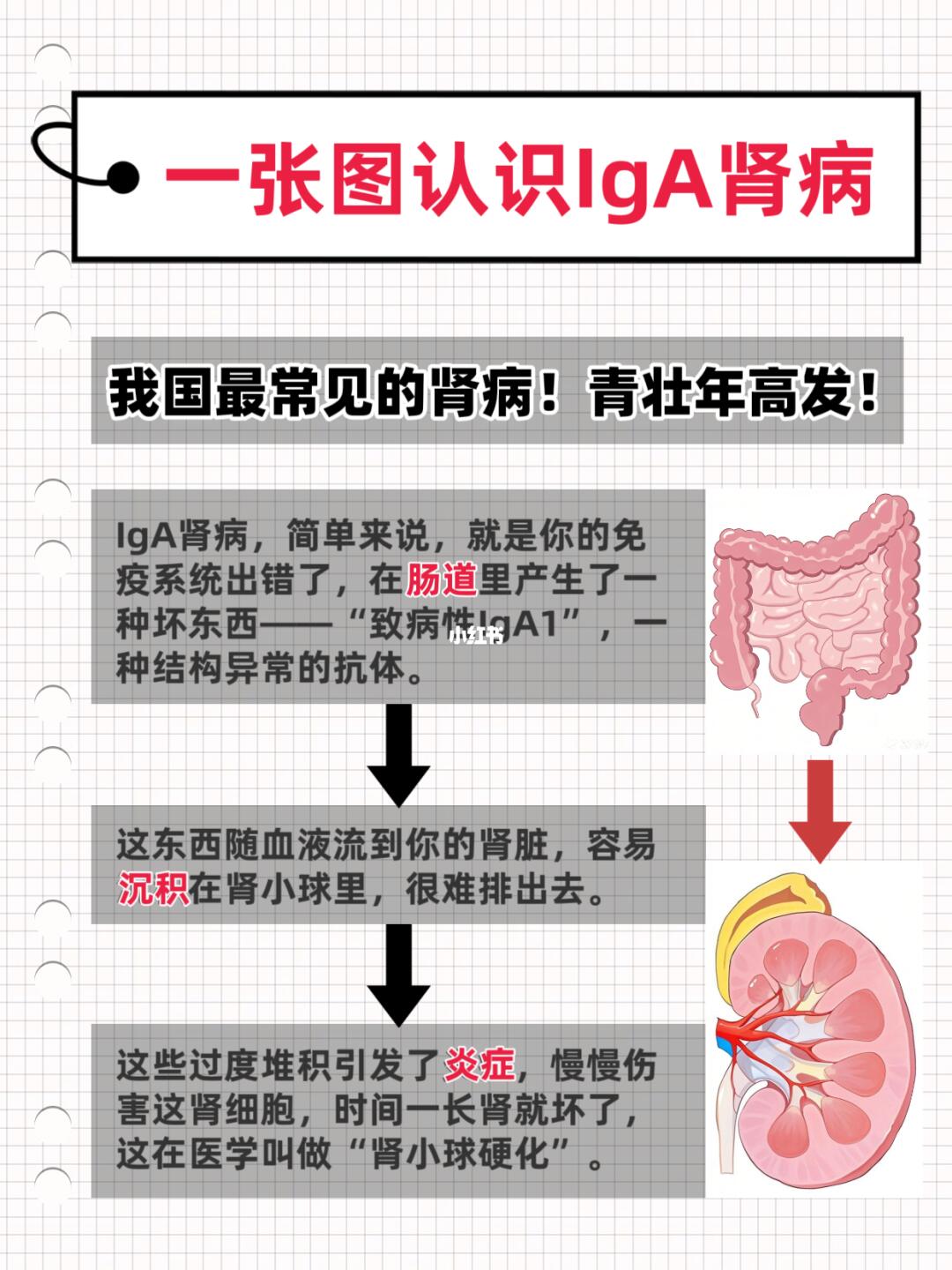 我国头号肾病IgA，青壮年要当心！
