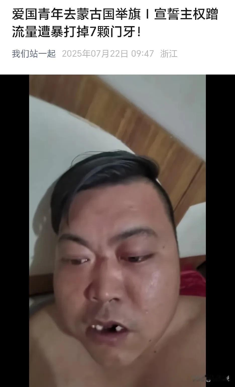 正能量爱国青年到蒙古国🇲🇳宣誓主权遭暴打，少了7颗牙太不容易了，这些