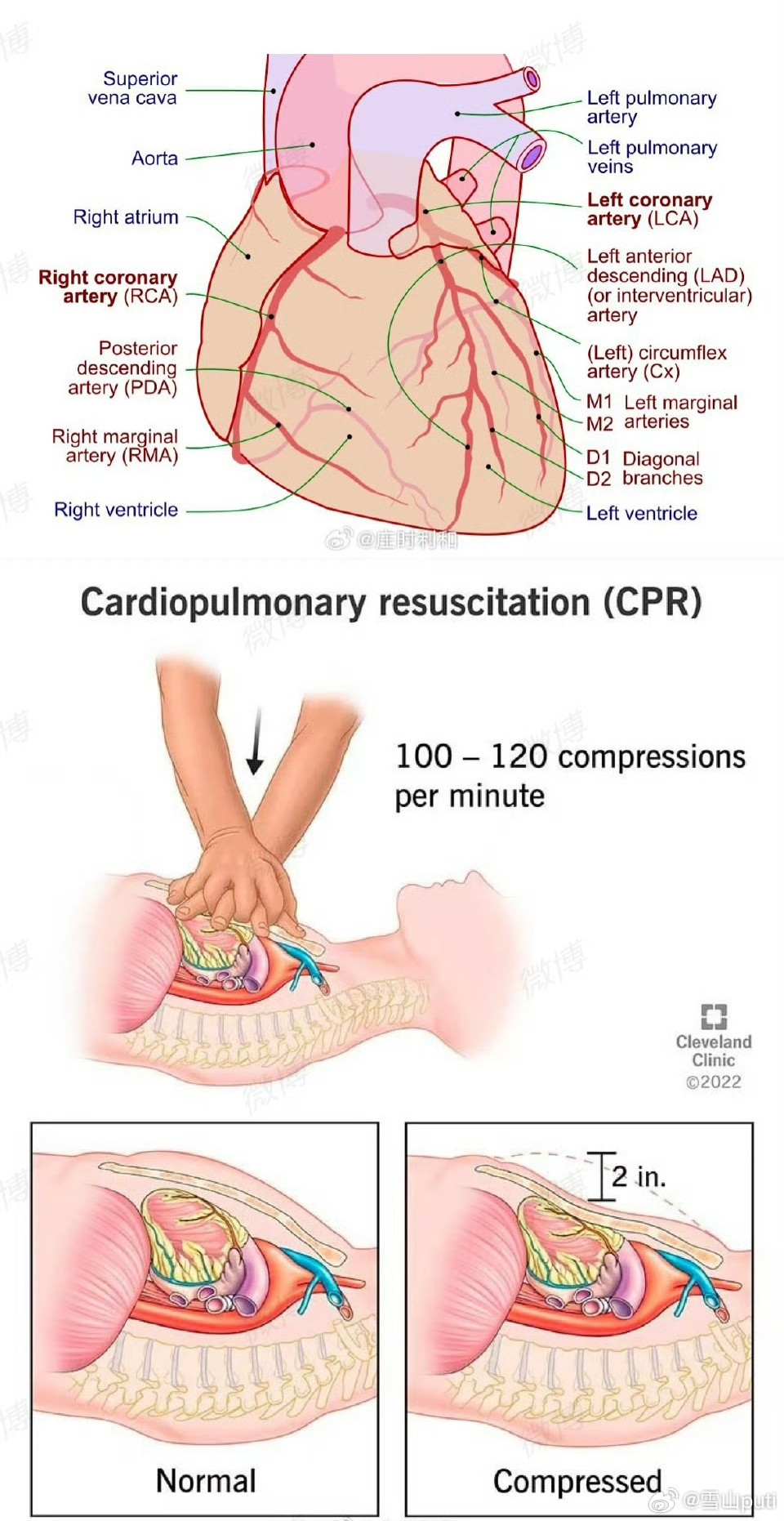 很明确的说一点，对于心脏骤停、心源性猝死来说，速效救心丸（以及日本那个救心丹）是