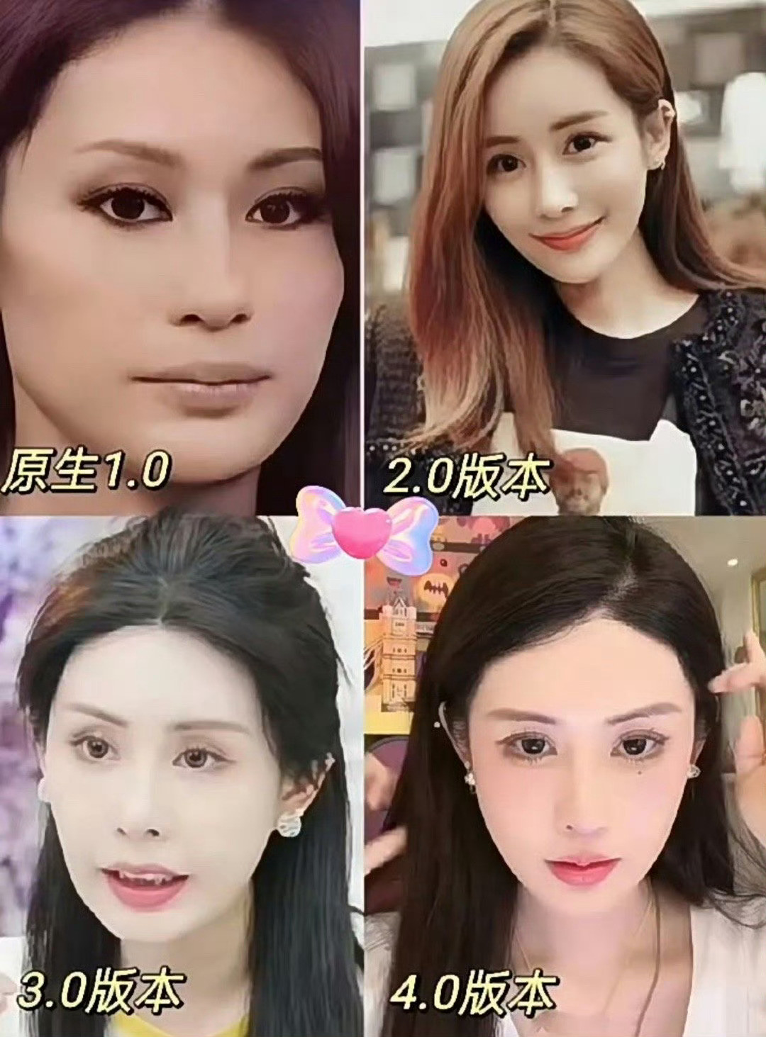 韦雪晒整容前照片你还能认出原生版本吗？差距真的不是一星半点呀！​​​