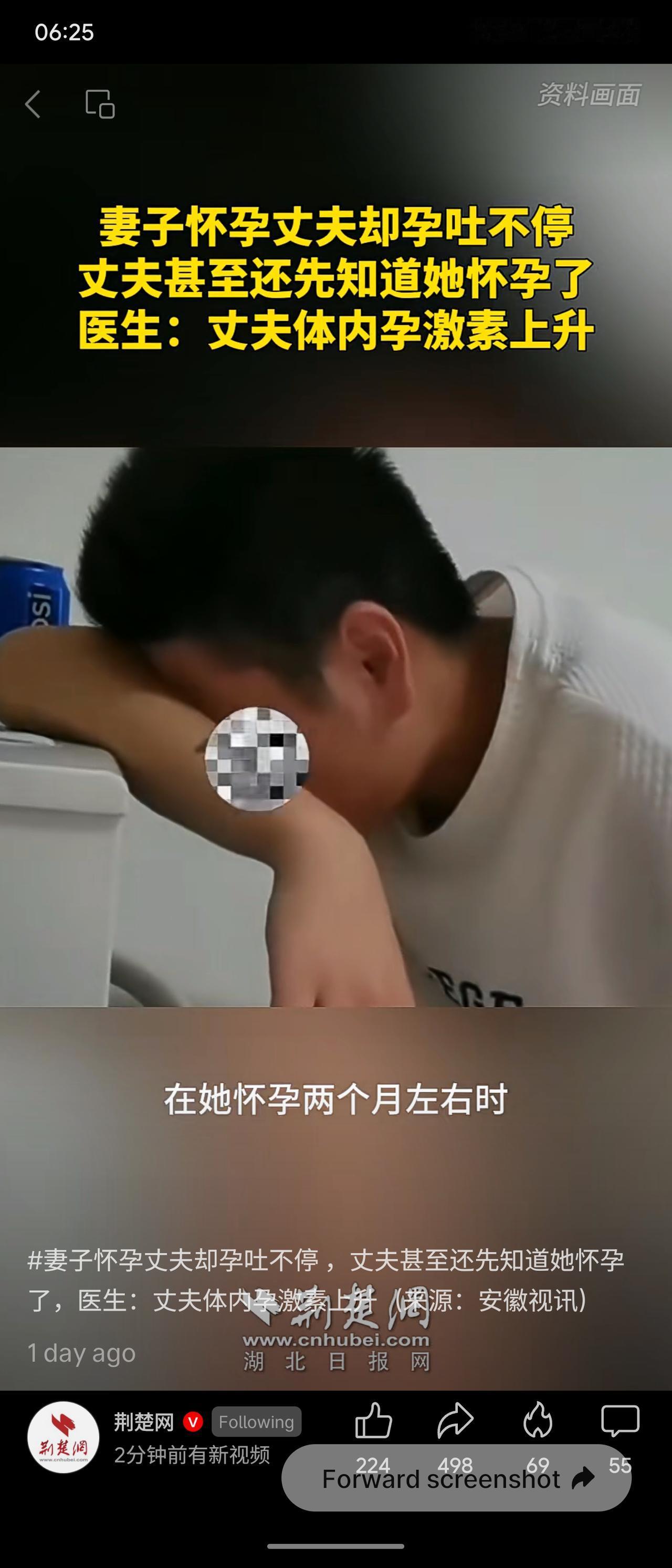 妻子怀孕后丈夫也出现孕吐，甚至更早察觉怀孕。这是因其体内孕激素同步上升所致，属于