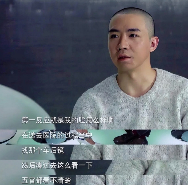 原来俞灏明全家都是狠人啊！俞灏明当年出事后，医生说他最可能活下来的办法就是割