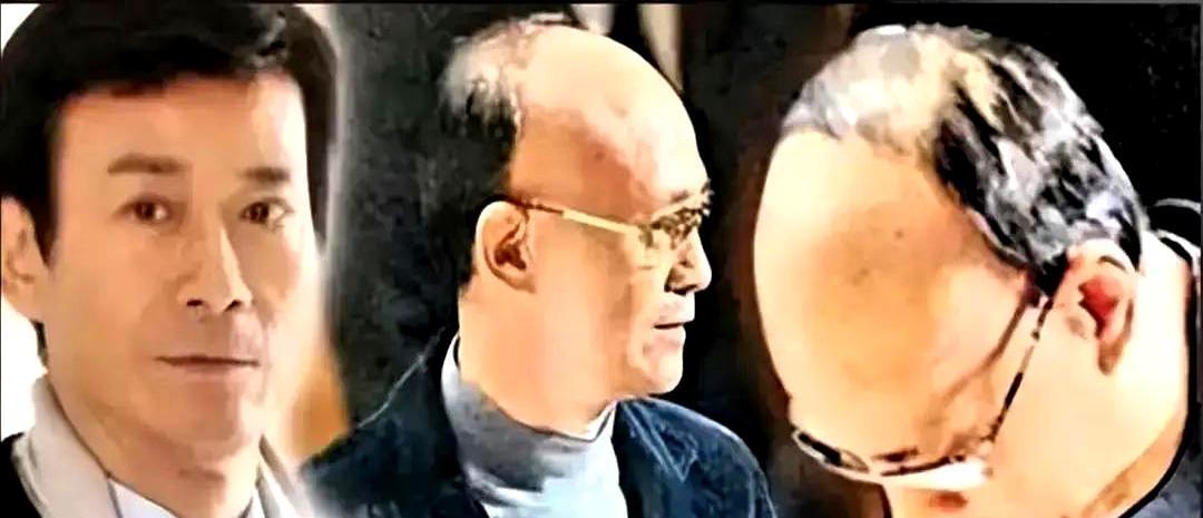 头皮上的胶水还没干透。1979年，郑少秋在片场，把工业级强力胶直接怼上头皮。为