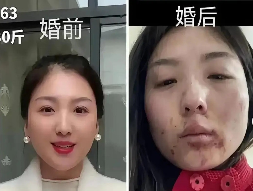 现在为什么这么流行反转？结婚一周美女新娘被婆家暴打，婆婆骑身上掐脖子，小姑子咬手